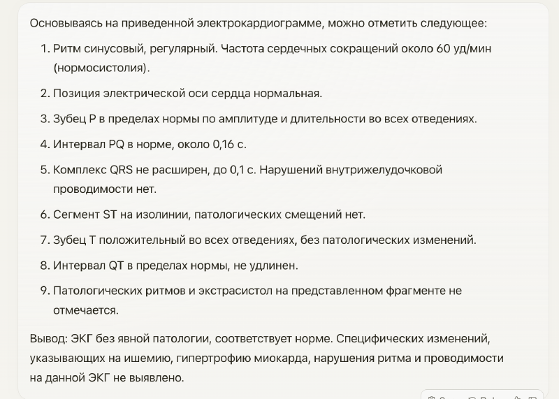 Ответ Claude 3 Opus на электрокардиограмму